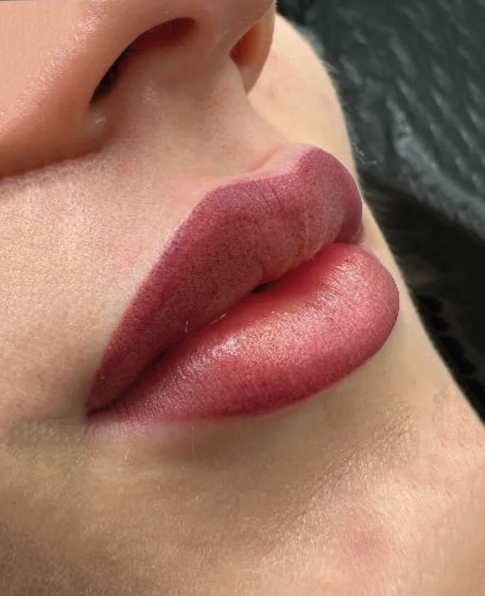 lippen Lippen