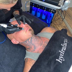 Hydrafacial